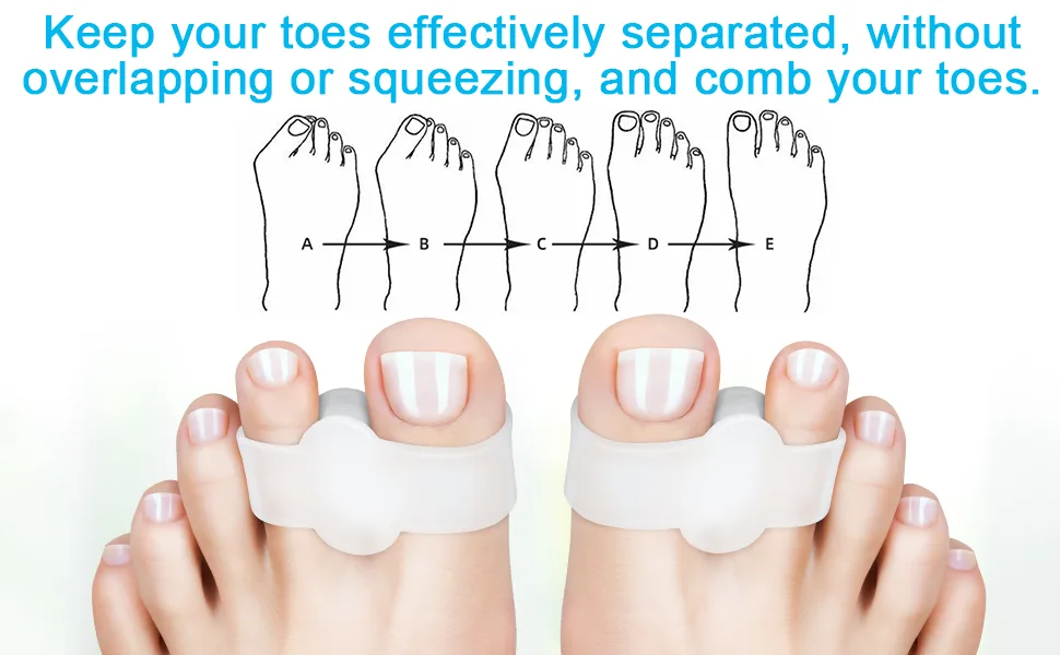 Golbylicc 8 Pairs Bunion Corrector Toe Separators for Women Men Gel Toe Spacers with 2 Loops for feet Big Toe Overlapping Toes (Clear) - Gel Toe Spacers Bunion Corrector with 2 Loops for feet