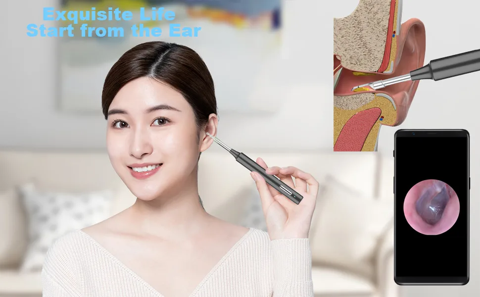 Ear Wax Removal Ear Cleaner with 3MP HD Camera Ear Wax Removal Tool 1080P Otoscope with Light - Ear Cleaning for iOS & Android (Black) - Ear Wax Removal Tool Camera