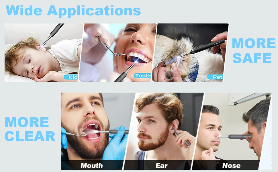 Ear Wax Removal Ear Cleaner with 3MP HD Camera Ear Wax Removal Tool 1080P Otoscope with Light - Ear Cleaning for iOS & Android (Black) - Ear Wax Removal Tool Camera