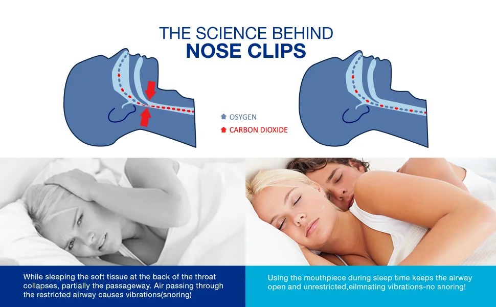 Snoring Nose Clip Nose Snore Stopper and Snoring Solution Effective Stop Snoring Device for a Better Sleep 4pcs Clear and Colorless - Snoring Solution