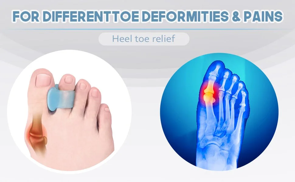 MHSY Toe Separators for Overlapping Toes 4PCS Gel Bunion Correctors Toes Spacers for Hallux Valgus and Hammer Toe Relieve Pain Blue - Toe Separators