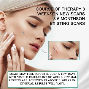 Medical Grade Silicone Scar Sheets (1.6 x60 ) Professional Scar Removal Sheets for C-Section Surgery Burn Keloid Acne et - SCAR