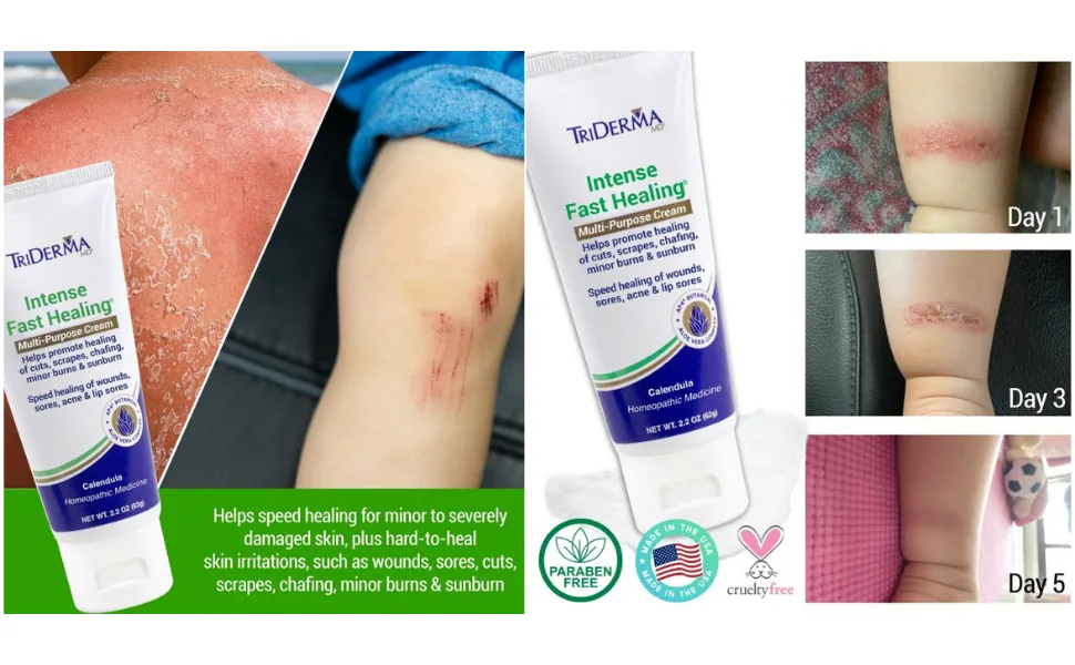 TriDerma Intense Fast Healing Multi-Purpose Cream for Cuts Scrapes Sores Chafing Minor Burns and Sunburn (2.2 oz Tube) - Fast healing