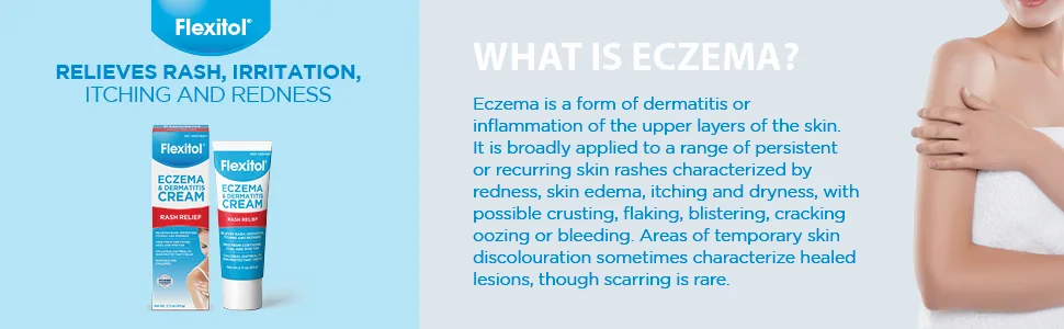 Flexitol Eczema & Dermatitis Cream  Steroid & Fragrance Free for Sensitive Irritated Skin with 5% Colloidal Oatmeal - What is Eczema?