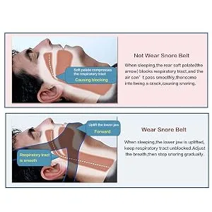 Sluffs Chin Strap Anti-Snoring Belt Shut-Up Adjustable Anti-Snoring Device Chin Support Strap Solution for Sleep - 03EJM02700