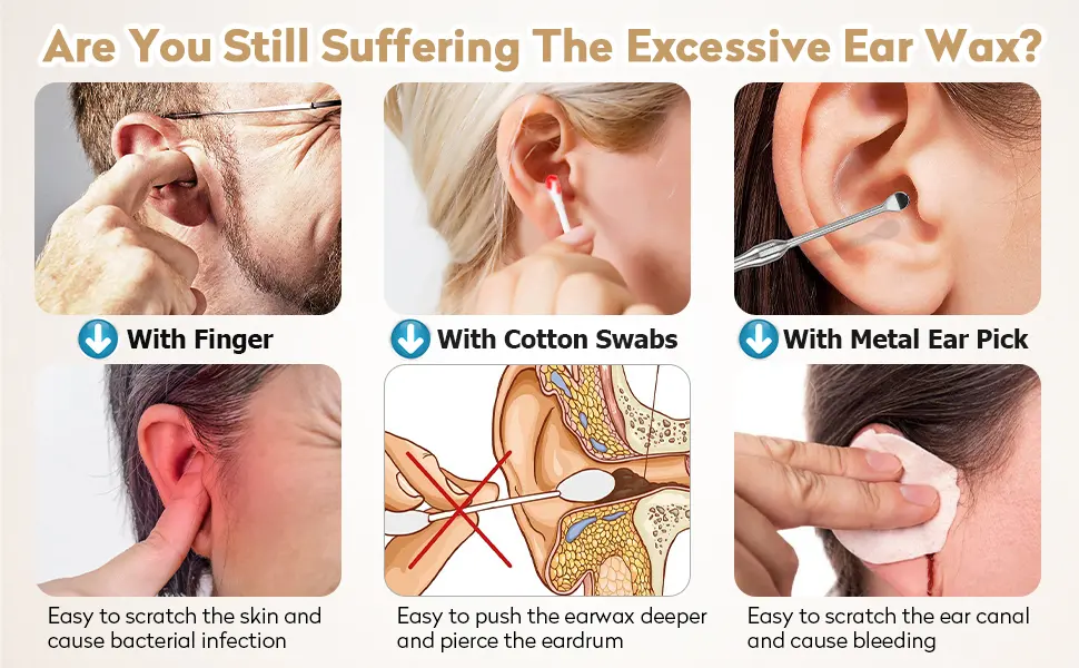 CAIROLLY Ear Wax Removal Kit Ear Candles Wax Removal Earwax Removal Tool Ear Cleaning Kit for Home Use Black - product information 4
