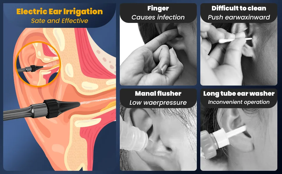 Ear Wax Removal - Ear Cleaner - EarCleaning Kit - Ear Irrigation Flushing System- Ear Wax Removal Tool Black - Ear Wax Removal