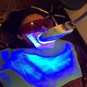 Vinmax Dental Lab Safety Glasses Goggle Glasses Anti-Fog Glasses Protective Eye for Curing Light Whitening - glasses