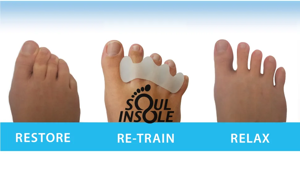 Premium Toe Spacers/Toe Correctors/Toe Separators by Soul Insole Large Size Large / Wide - correct toes, toe spacers, toe separators, bunion spacer, hammer toe spacers, gel pad, insole insert