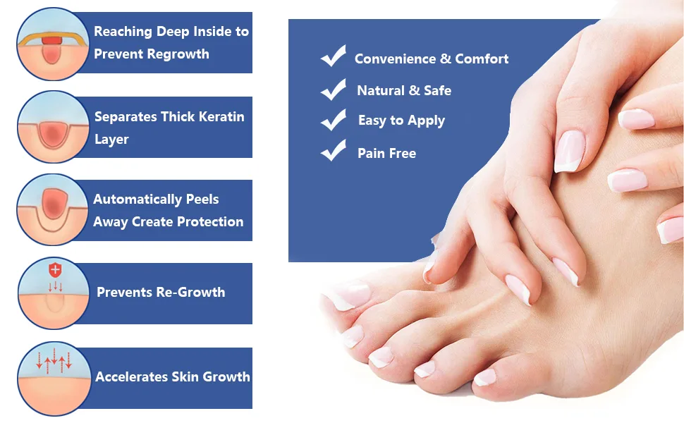 Corn Removers for Feet & Toes Corn Removers Pads - Maximum Strength (12PCS) - Corn Removers Pads
