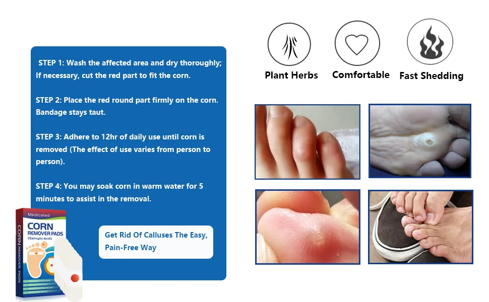 Corn Removers for Feet & Toes Corn Removers Pads - Maximum Strength (12PCS) - Corn Removers Pads