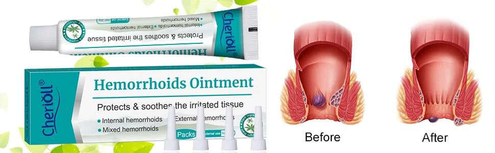 Cream 20g*2 (Assistant tub 4Pcs) - product information 2