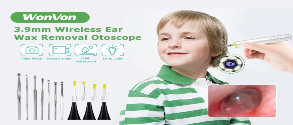 Ear Scope Ear Wax Removal Tool Camera Wireless Otoscope 1080P Ear Cleaner Camera Otoscope with Light Ear Wax Remover Ear Endoscope Compatible with iPhone iPad Android - Ear Scope, Ear Wax Removal