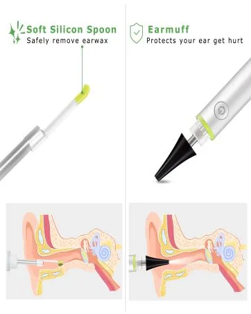 Ear Scope Ear Wax Removal Tool Camera Wireless Otoscope 1080P Ear Cleaner Camera Otoscope with Light Ear Wax Remover Ear Endoscope Compatible with iPhone iPad Android - Otoscope with Light