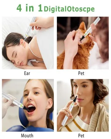 Ear Scope Ear Wax Removal Tool Camera Wireless Otoscope 1080P Ear Cleaner Camera Otoscope with Light Ear Wax Remover Ear Endoscope Compatible with iPhone iPad Android - Otoscope with Light