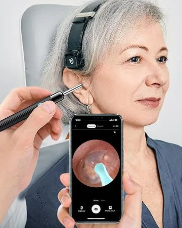 Ear Wax Removal Ear Cleaner with Camera Ear Wax Removal Kit with 1080P Ear Camera Otoscope with Light Ear Cleaning Kit for iPhone iPad Android Phones-White - product information 7