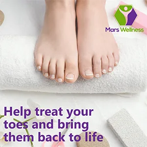 Mars Wellness Gel Toe Separators 1 Pair - Correct Bunions Overlapping Toe Crooked Toe - Hammer Toe Straightener Spacer - Universal Size - product information 13