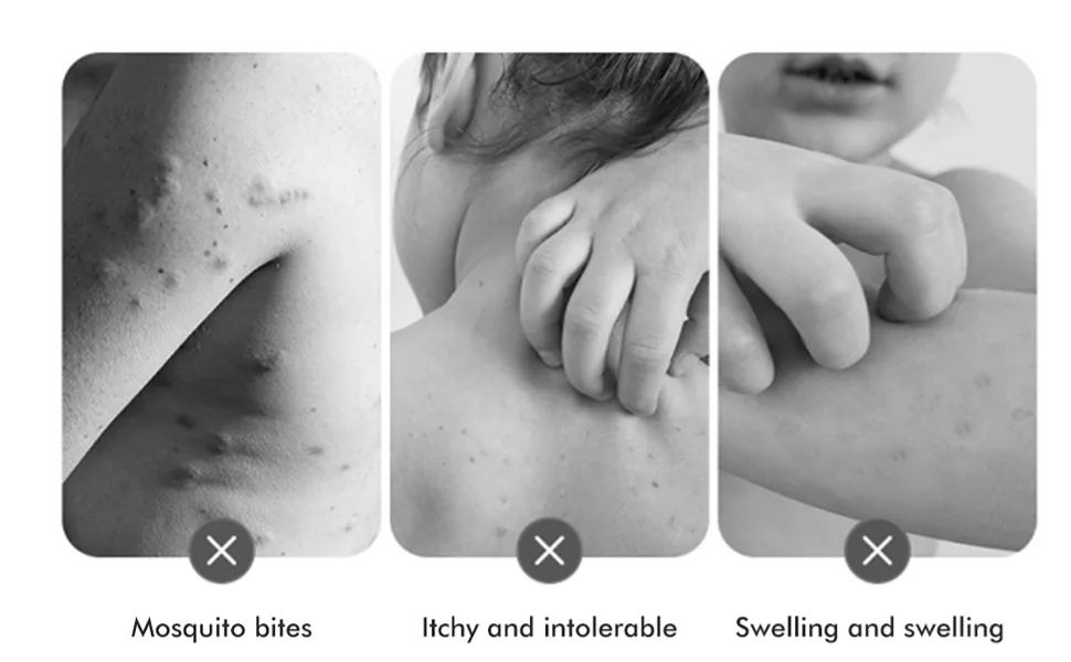 Bite Relief Pen Heating Bite Healer USB Charging Reduce Itching Safe Heat Pulse Sting Healer for Child Adults - Bite Relief