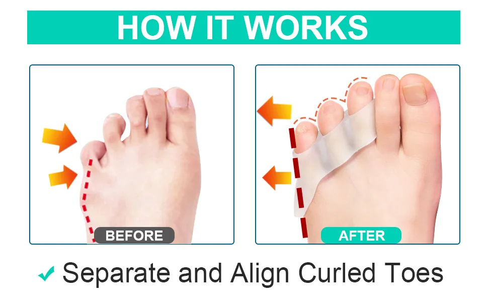 Sumifun Pinky Toe Separators 12 Packs Clear Little Toe Spacers for Small Toes Toe Separators for Overlapping Toes Curled Toes Clear-12 Pack - product information 8