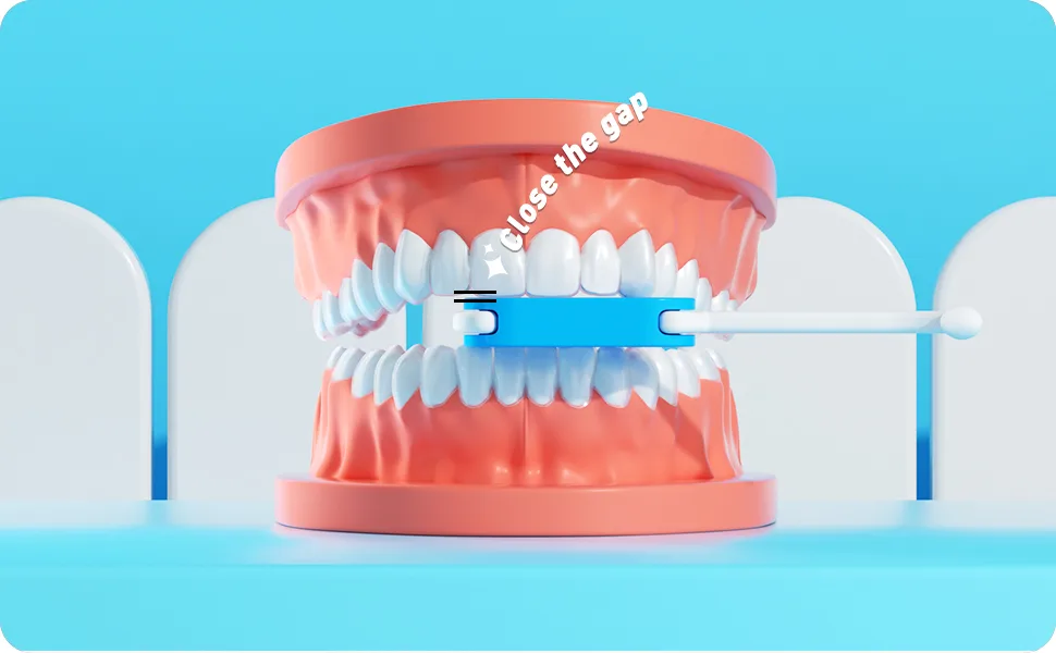 2 in 1 Aligner Removal Tool & Chewies for Invisalign Braces Trays Compatible with Aligners Retainers Dentures with Brush- 2 Pack & 2 Replacement Blue - retainer case
