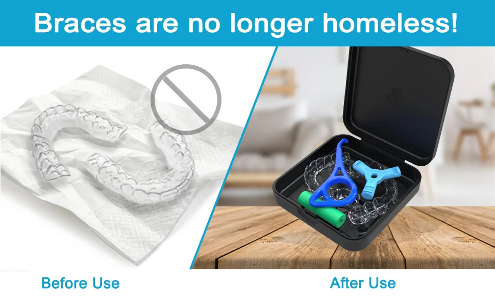 Retainer Case ARGOMAX Aligner Case Braces Box 1 Piece Orthodontic Box (Pink). 1 PCS Pink - Retainer Case