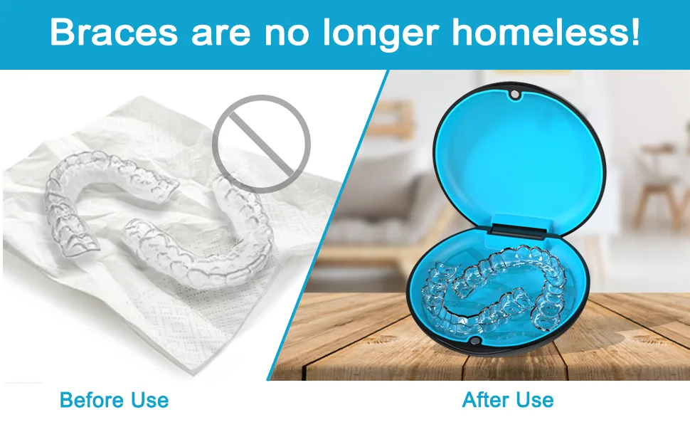 ARGOMAX Aligner Case Retainer Case Braces Box 1 Piece Orthodontic Box (Pink + Light Blue Silicone). - Retainer Case
