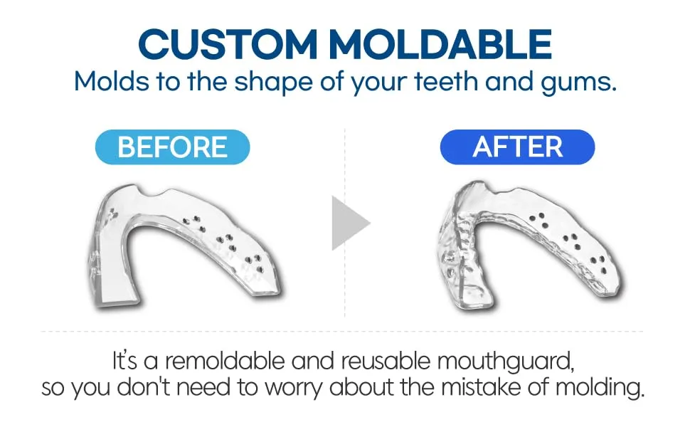 Mouth Guard for Grinding and Clenching Teeth at Night Custom-Fit Custom Moldable Sleep Night Guard with Travel Hygiene Case Reusable - Moldable