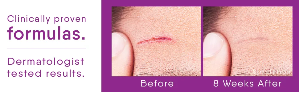 Cicatricure (Pack of 2) - Cicatricure Scars