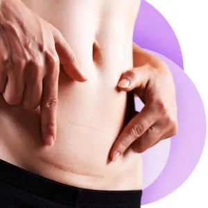 Cicatricure (Pack of 2) - Image_01