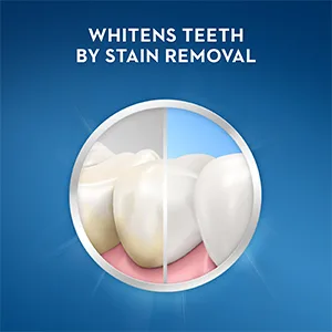 Crest 3D White Stain Eraser Whitening Toothpaste Icy Clean Mint 2 Count 3.5 Ounce (Pack of 2) Icy Clean Mint - Whitens teeth by removing stains