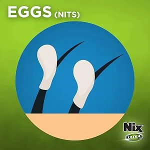 Nix Ultra Lice Shampoo & Egg Removal Comb Lice Removal Treatment 3 Fl Oz 1 Count - Nix Ultra
