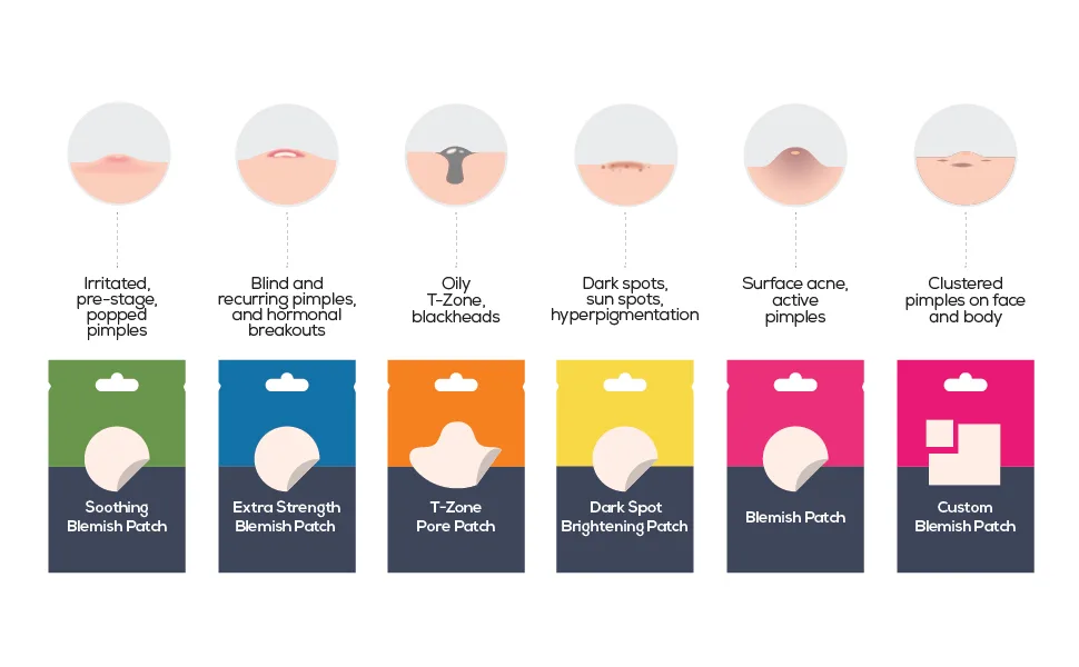Hanhoo Custom Blemish Patch | Large Hydrocolloid Patches | For Face and Body Acne and Blemish Clusters | Customizable Pimple Patch Sheets | Cruelty-free & Vegan | 2 Patch Sheet Count - stages