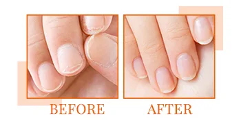 Nail Tek Hydrate 2 Moisturizing Strengthener for Soft and Peeling Nails Nourish Protect Nails from Chips Splits Peeling and Breakage 0.5 oz 1-Pack - Nail Tek Hydrate 2, Moisturizing Strengthener For Soft, Peeling Nails, 0.5 oz, 1-Pack