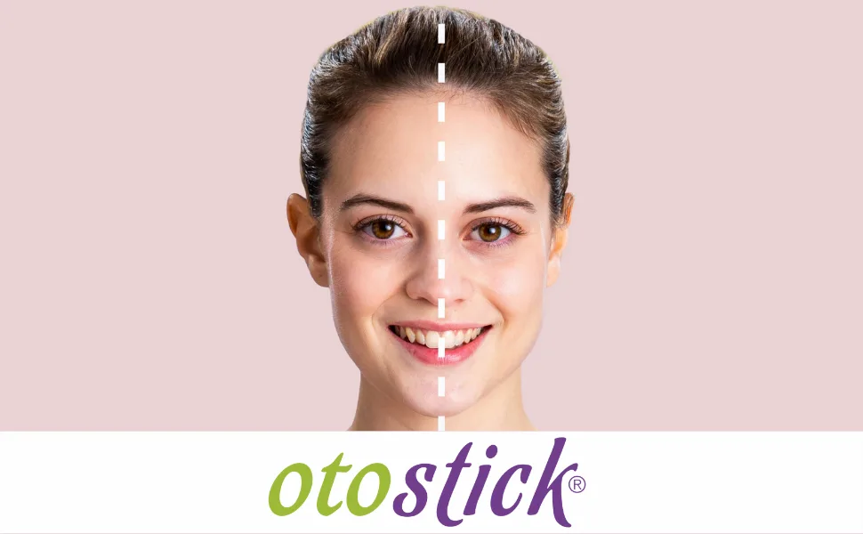 Otostick - 2 Pack 8 Count Cosmetic Discreet Protruding Ear Corrector - Corrective Ear Care Products for Ear Pinning without Surgery from 3 Years. - Otostick Banner Image