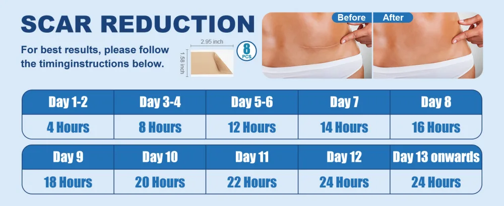 8 Pack Scar Away Silicone Scar Sheets Breathable & Reusable Silicone Scar Tape Ultra-Thin Silicone Scar Strips for C-Section Surgery Burn Post Surgery & Stretch Marks - scar away silicone scar sheets