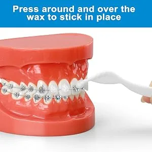 (10 Pack) Braces Wax-Dental Wax for Braces & Aligners 50 Premium Orthodontic Wax Strips-White - tool