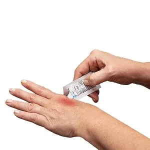 Globe First Aid Burn Cream 0.9g Packets (Box of 144) Advanced First Aid Cream for Temporary Relief of Minor Burns Cuts and Scrapes - burn