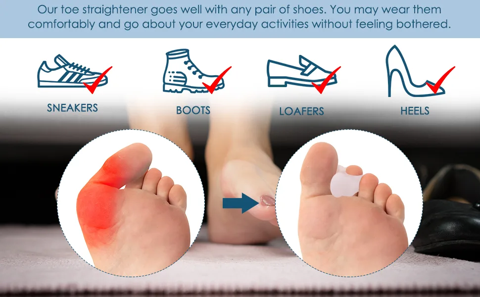 AllSett Health 8 Pack Toe Separators for Bunions - Toe Spacers Hammer Toe Straightener Correct Toes and Bunion Relief - Our bunion spacer helps prevent toe rubbing