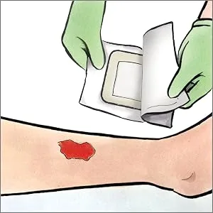 Medline Sterile Bordered Gauze 3 x 6 with 1.5 x 4 Pad (Pack of 15) - Bordered gauze; adhesive dressing; wound dressings; wound gauze;