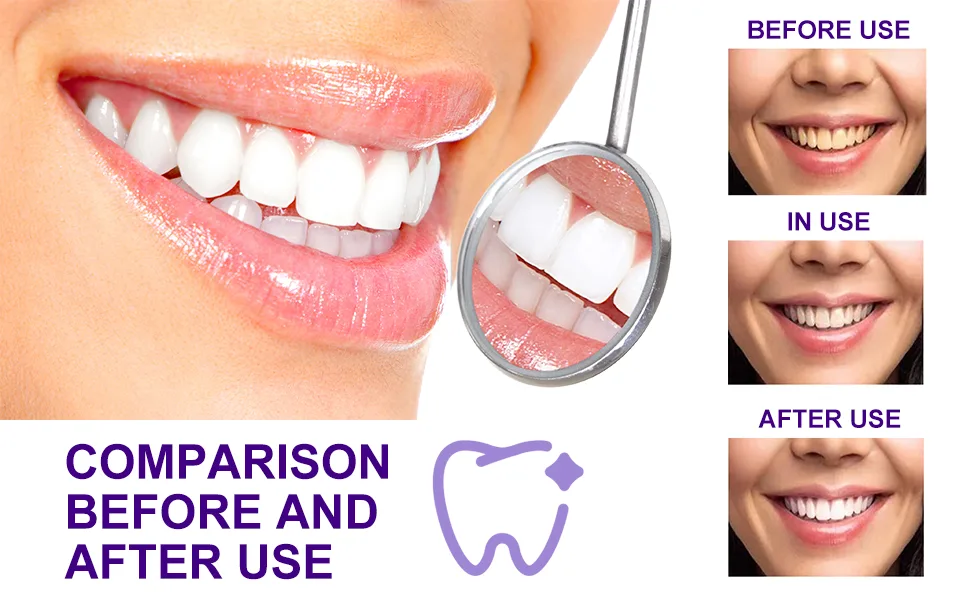 Teeth Whitening Toothpaste 2 Pack Purple Toothpaste for Teeth Whitening Color Corrector Toothpaste Toothpaste Sensitive Teeth Remove Stains Improves Teeth Brightness and Reduce Yellowing - v34 color corrector toothpaste
