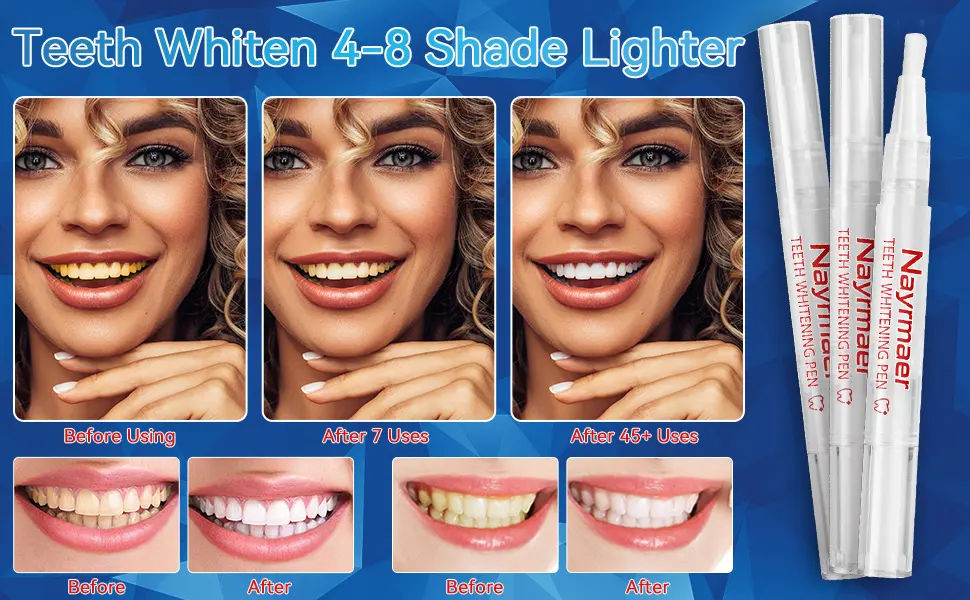Teeth Whitening Pen 3 Packs Teeth Whitening Essence Painless Whitening for Sensitive Teeth Safe Effective Mint Flavor (Mint) - Teeth Whitening Pen