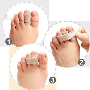 JKcare Broken Toe Wraps 8 Pack Improved Hammer Toe Cushion Bandages Toe Buddy Separator Splint for Overlapping Bent Crooked Toe Pain Relief - Temporary Toe Straighteners - Gently realigns hammer toes, overlapping or crooked toes to avoid further friction and irritation