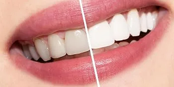 Nu Skin AP 24 Whitening Fluoride Toothpaste 2-pack - Teeth