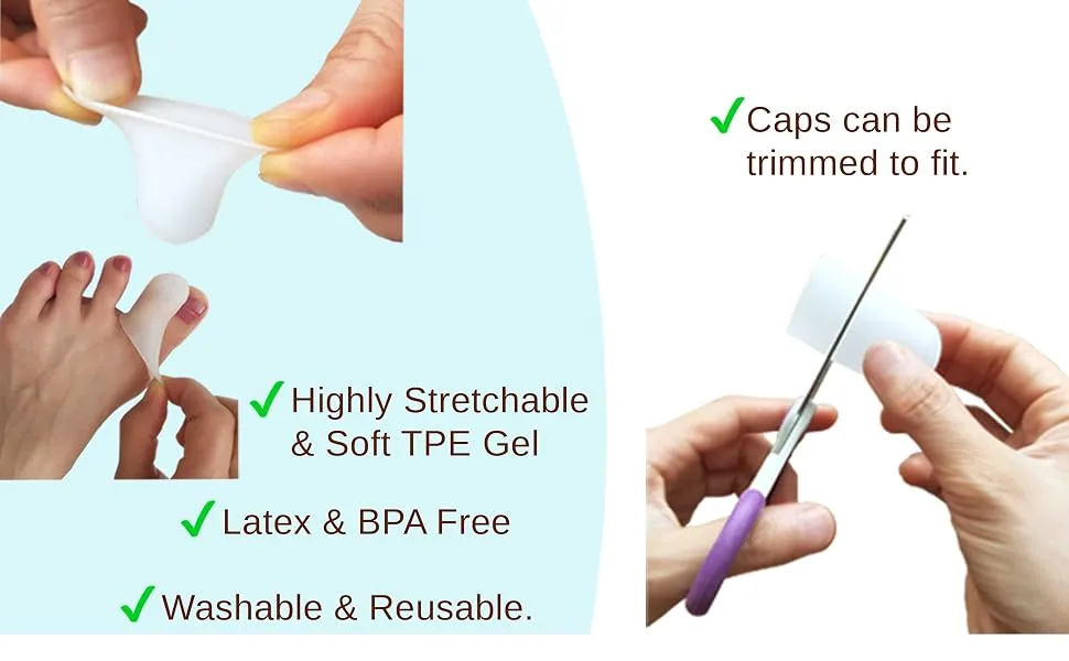 Chiroplax Gel Toe Cap Sleeve Protector Cushions Pads Guard Cover Separator Bunion Hammer Toe Callus Corn Blister Missing Ingrown Nails (Small - 10 Pack White) Small (10 Pack) White - Chiroplax toe cap sleeve protector tube for callus corn blister hammer toe bunion mallet bent toe