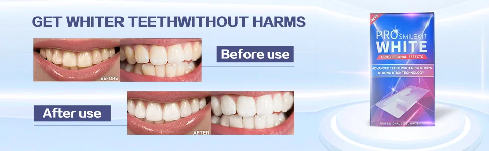 Maycharm Teeth Whitening Strips Reduced Sensitive White Strips Enamel Safe Teeth Whitening Strips Whitening Without The Harm (14 Strips (7 Count Pack)) - Teeth Whitening Strips