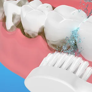 Replacement Flossing Toothbrush Heads for Water Pick SF-01 / SF-02 / SF-03 / SF-04 with Crystal Cap- Compact - 3 Count - White - product information 3