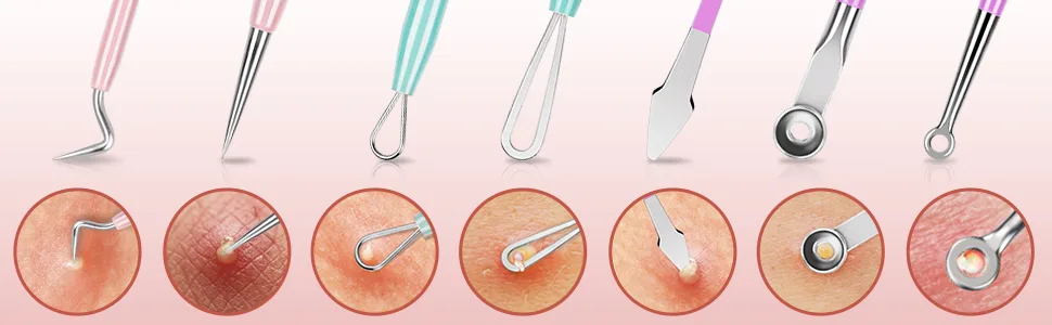 Blackhead Remover Tools MORGLES 15PCS Pimple Popper Tool Kit Professional Stainless Comedone Pimple Extractor Tool for Blackhead Blemish Zit Removing with Metal Case - Blackhead remover tools