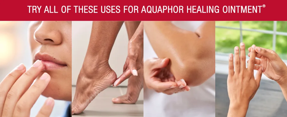 Aquaphor Healing Ointment Advanced Therapy Skin Protectant Dry Skin Body Moisturizer 0.25 Oz Jar Pack of 6 - aquaphor healing ointment, multipurpose solution, dry skin, cracked lips, chapped lips