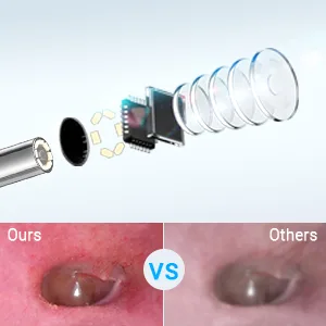 Anykit Ear Wax Removal Tool HD Otoscope for Android and PC-NOT for iPhone/iPad Ultra Clear View Ear Camera with Wax Remover LED Lights Ear Spoon Storage Case - HD otoscope