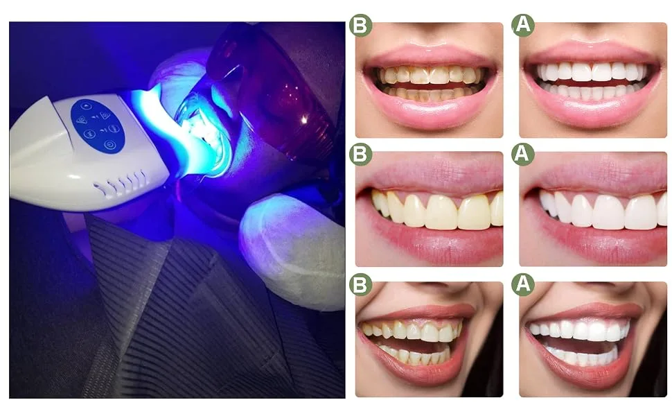 vinmax Red Goggle Glasses Lab Eye Protection Safety Glasses Tansparent Dental Protective Eye Curing Light Whitening 1pc - LED Teeth Whitening Light Bleaching 3 Mode Light Lamp Accelerator